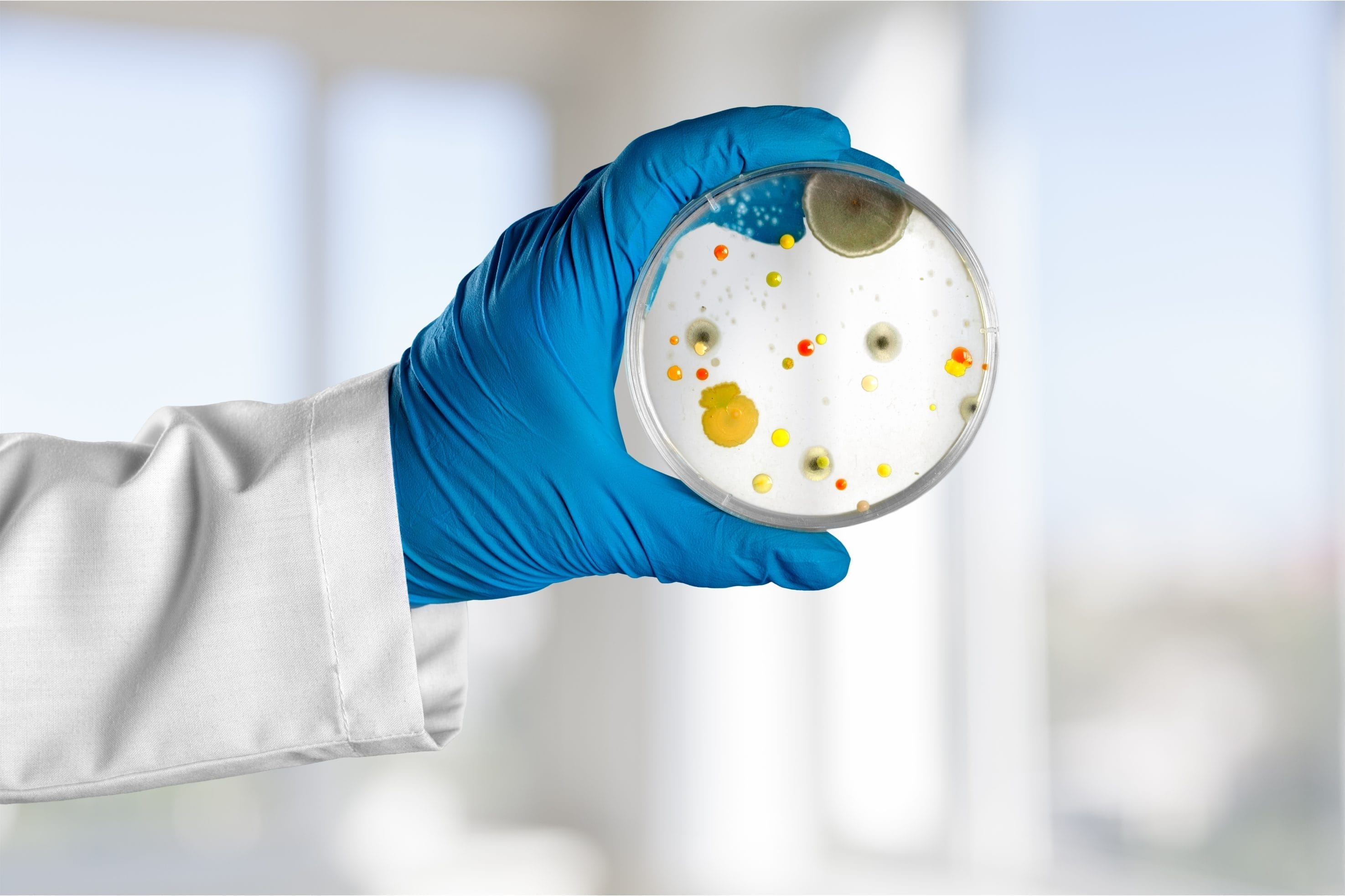 An arm with a lab coat and blue glove holding a Petri dish with mold growing on it.